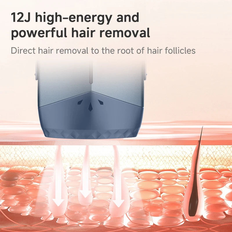 MLAY T18 Ice Cooling IPL Hair Removal Device Home Use