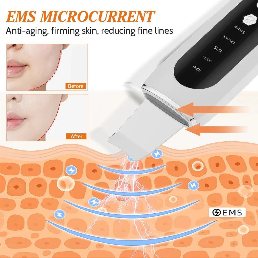 Ultrasonic Skin Scrubber Deep Pore Cleaner Facial Cleansing Tool