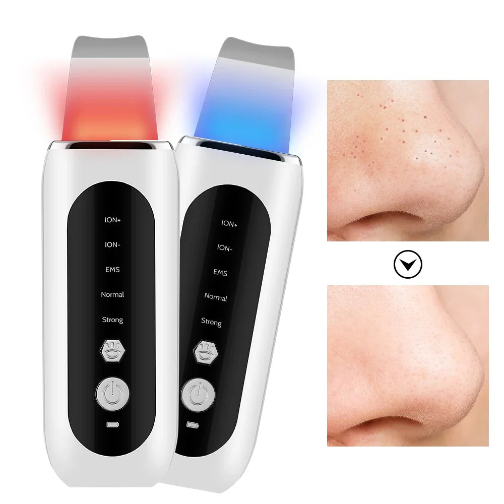 Ultrasonic Skin Scrubber Deep Pore Cleaner Facial Cleansing Tool